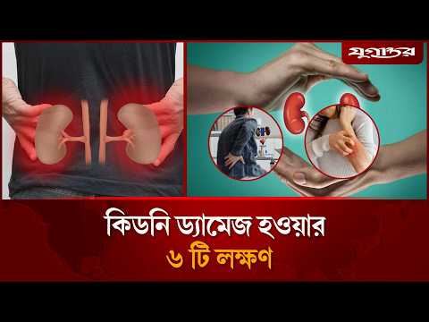 কিডনি ড্যামেজ হওয়ার যে ৬ লক্ষণ অবহেলা করবেন না | Kidney Health | Kidney Damage | Jugantor