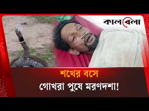 শখের বসে গোখরা পুষে ম\রণদশা | Snake Bite | Bangladesh | Kalbela News